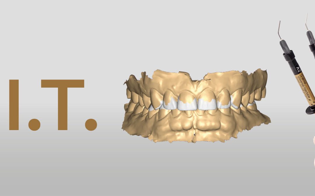 Making restoration easier for dentists with F.I.T.