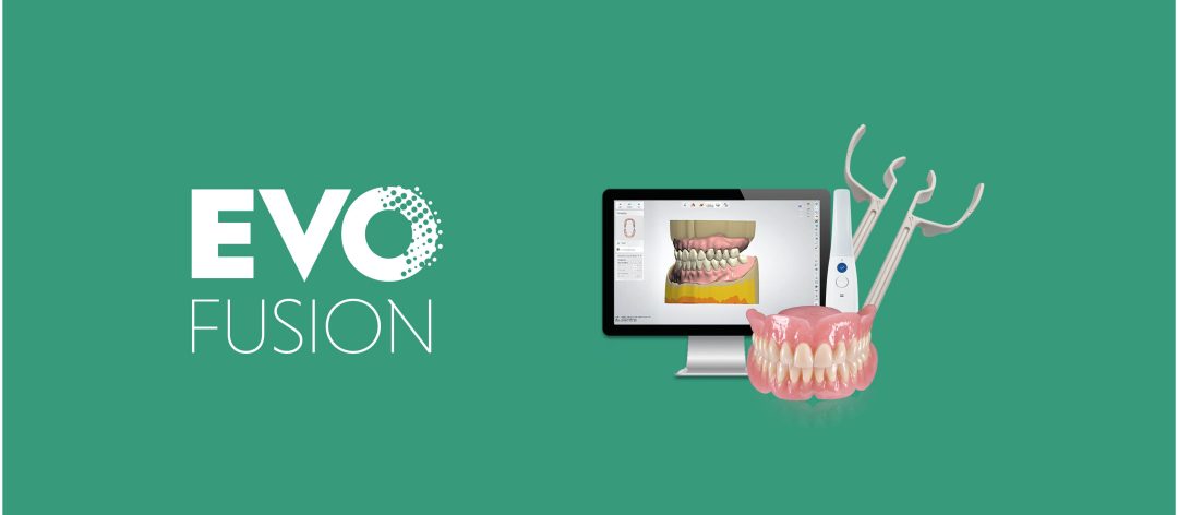 EVO Fusion innovative solutions for removable dentures