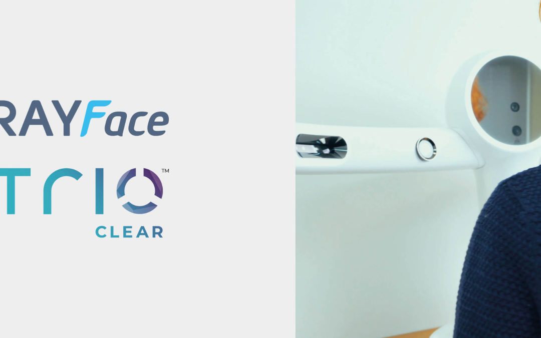 TrioClear™ iDesign 2.0 with RAYFace integration