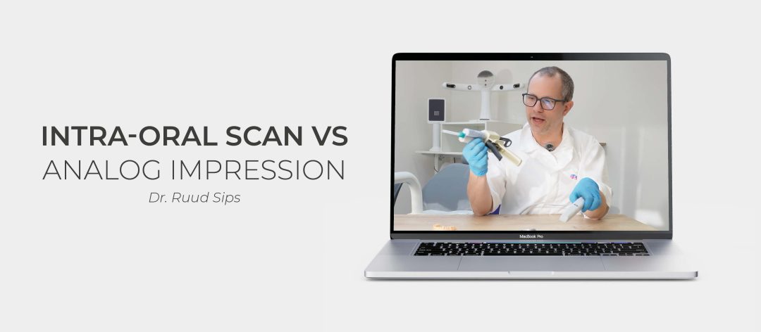 Why choose an intraoral scanner over traditional analog printing?