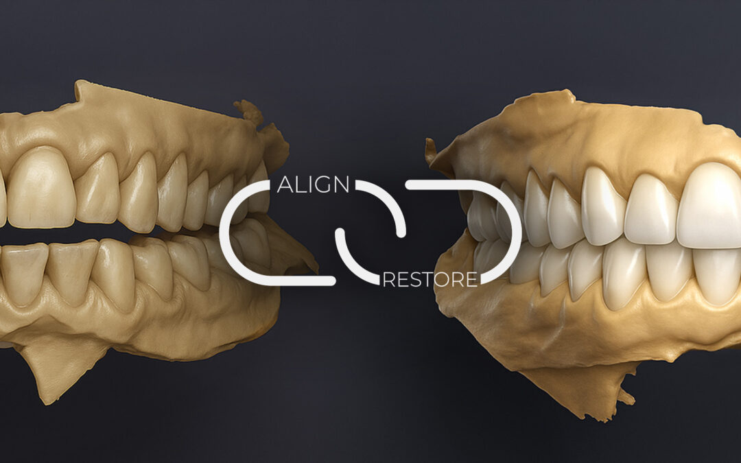 What is the benefit of Pre-Restorative Alignment in Minimally Invasive Dentistry (MID)?