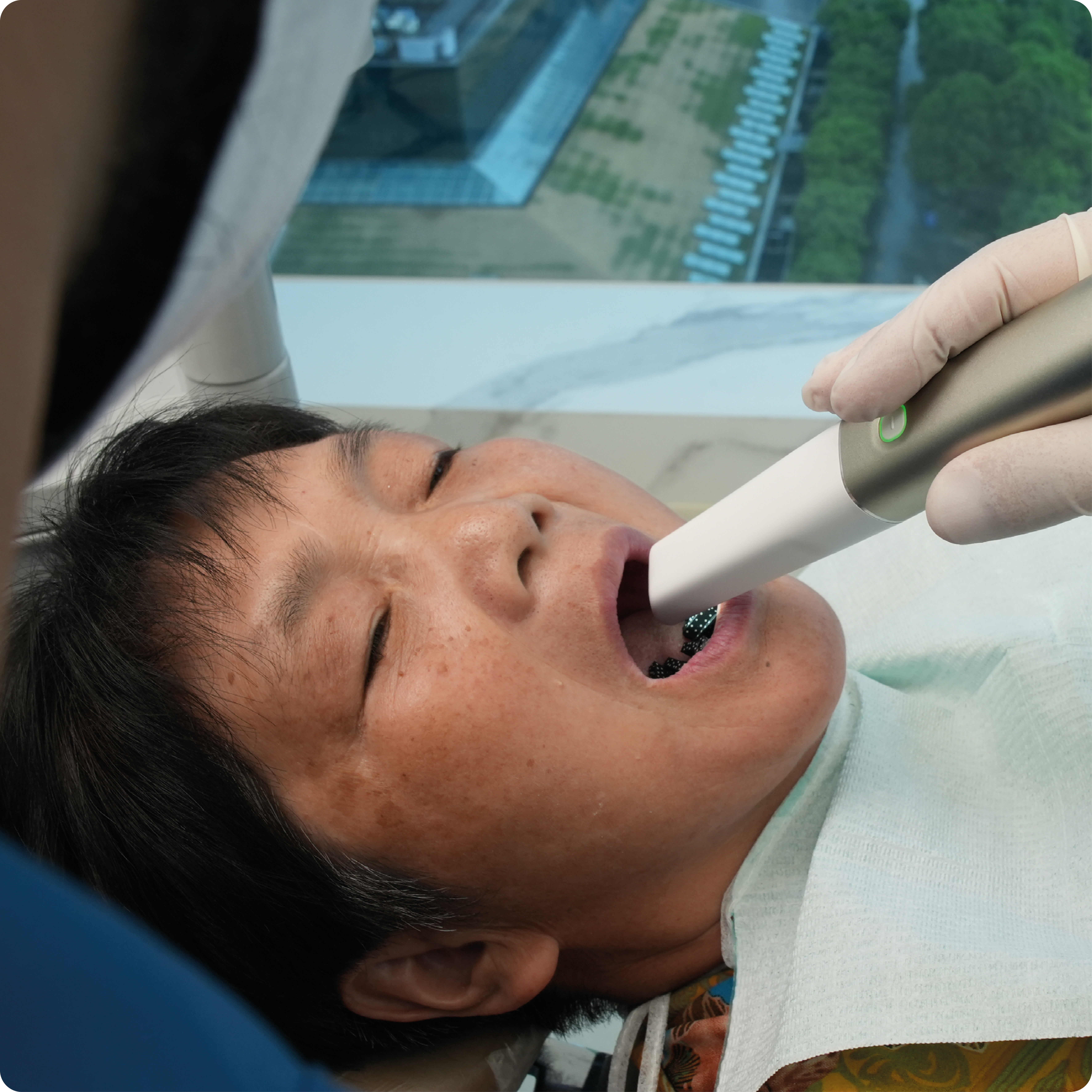 Aerolscan Elite Male Patient Scan